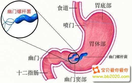 如何根除幽门螺杆菌_幽门螺杆菌根治方法