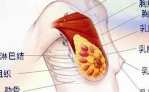 乳腺增生不是乳腺癌的早期 有些乳腺增生不需要治疗 乳腺增生不是乳腺癌的早期 有些乳腺增生不需要治疗