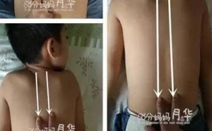 小儿哮喘有哪些症状表现 治疗哮喘的推拿手法(图解）