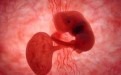 怀孕胚胎停育有哪些症状？引起胚胎停育的N种原因(图)