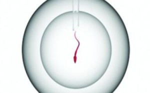 精子数量少、子宫颈倾斜等不孕不育夫妻可以在家自助人工授精 