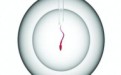 精子数量少、子宫颈倾斜等不孕不育夫妻可以在家自助人工授精 