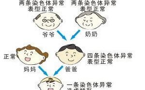 染色体异常的原因_新生儿多种畸形皆因染色体异常引起的 