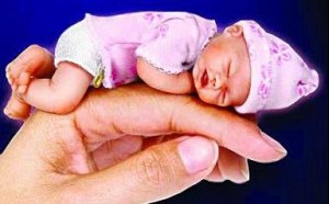 如何区分血管瘤和胎记?警惕“红胎记”有可能是血管瘤 如何区分血管瘤和胎记?警惕“红胎记”有可能是血管瘤