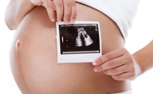 孕早期做NT检查 查些什么项目？nt检查有必要做吗？