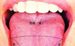 中医小儿的舌诊辨证_ 通过舌诊辨别宝宝病因（图）