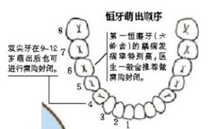 孩子有必要做窝沟封闭吗？窝沟封闭几岁做最好