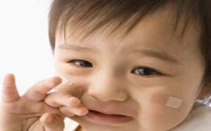 怎么预防宝宝出血及流血了怎么办