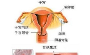 女性宫颈糜烂有哪些症状表现 宫颈糜烂的治疗方法