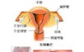 女性宫颈糜烂有哪些症状表现 宫颈糜烂的治疗方法