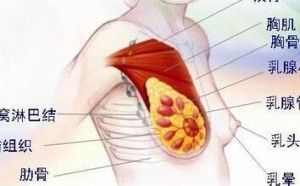 女性得了乳腺癌怎么办 女性得了乳腺癌怎么办