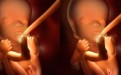 胎儿在子宫内发育全过程图片大全(3D组图）