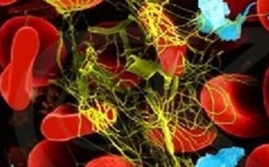 小儿血小板低的原因