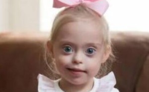 引起唐氏综合症的原因及治疗方法 引起唐氏综合症的原因及治疗方法