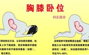 胎位不正怎么办?纠正胎位不正的方法(图) 胎位不正怎么办?纠正胎位不正的方法(图)