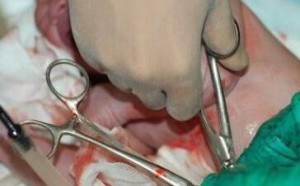 顺产怎样避免侧切手术?孕妇学会五招躲过侧切 顺产怎样避免侧切手术?孕妇学会五招躲过侧切