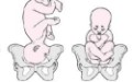 胎位不正别坐等剖腹产 方法用对可纠正过来顺产