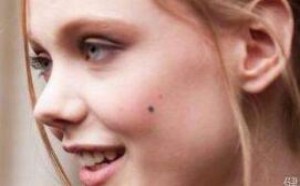 面部点痣后的注意事项