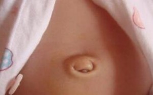 宝宝疝气的症状有哪些