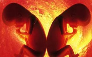 双胞胎那些事你知道吗,揭密双胞胎是怎么形成的 双胞胎那些事你知道吗,揭密双胞胎是怎么形成的