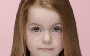 雀斑会遗传给孩子吗？女孩遗传几率大于男孩