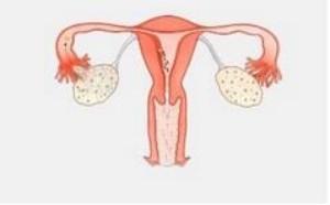 女性为什么会阴吹，出现阴道排气该怎么办？