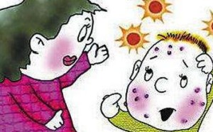 水痘是如何传染的？如何预防水痘传染