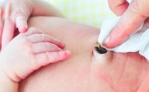 别用酒精和爽身粉护理脐带 新生儿脐带的正确护理方法 