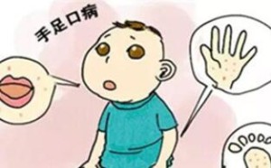 教你快速辨别4种跟手足口病极相似的疾病