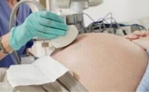 孕期b超做多了对胎儿有没有影响，会造成宝宝畸形吗？