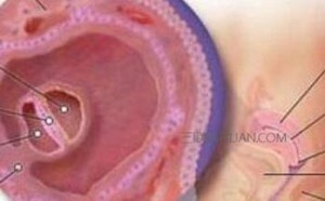 子宫内膜增厚会癌变吗？子宫内膜增厚治疗方法有哪些？