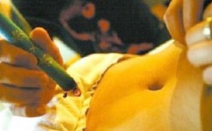 艾灸的作用之大 备孕期间可以艾灸吗？会影响怀孕吗？