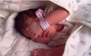 小儿艾滋病初期症状表现是什么 具有哪些特点 小儿艾滋病初期症状表现是什么 具有哪些特点