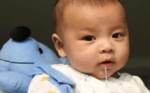 婴幼儿期呆小症的表现症状及防治方法