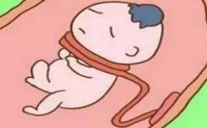 胎儿脐带绕颈一周怎么办,还能顺产吗? 胎儿脐带绕颈一周怎么办,还能顺产吗?