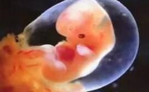 胚胎停育的原因可能与这八大“隐形杀手”有关