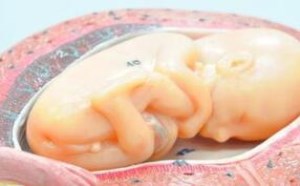 胎儿的体重是用什么方法测算的