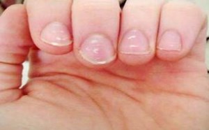 宝宝手指甲上出现白点是怎么回事