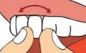 梦见自己牙齿掉了预示着什么意思