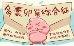 多囊卵巢综合症的症状有哪些 多囊卵巢综合症的症状有哪些