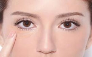 怎么减轻眼袋做精致漂亮女人