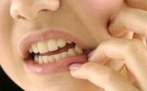 牙龈肿痛怎么办 吃什么药立刻止疼