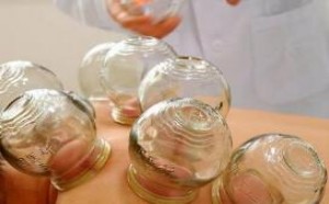 拔罐的好处和坏处分别有哪些