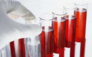 解读血常规能检查出什么病