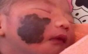 婴儿出生为什么有胎记?原来是准妈妈孕期做了这些事 婴儿出生为什么有胎记?原来是准妈妈孕期做了这些事