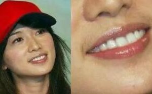 女生长小胡子咋办？饮食方面要注意些什么