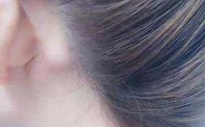 耳朵后面长了个硬包是怎么回事啊 耳朵后面长了个硬包是怎么回事啊