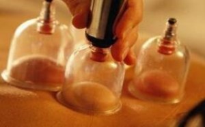 拔罐后皮肤颜色鉴别 反映身体状况是怎么样的 拔罐后皮肤颜色鉴别 反映身体状况是怎么样的