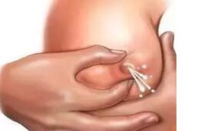 正确的催乳按摩手法步骤图解 增加产奶量