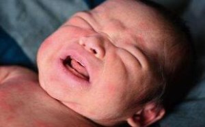 宝宝在床上被螨虫咬伤的症状图片